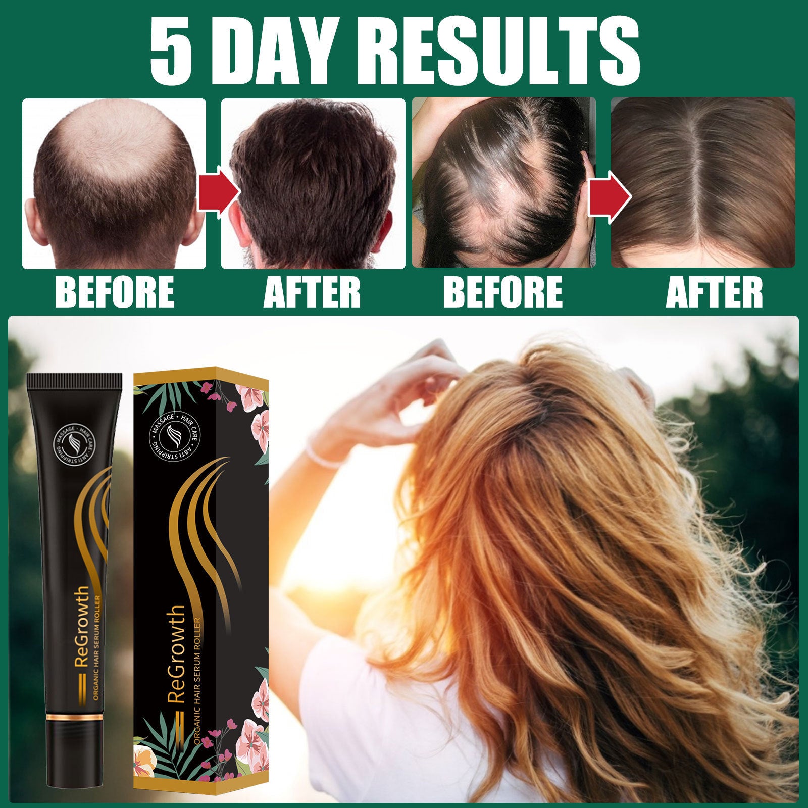 Regrowth Organic Hair Serum Roller Set Hair Care Anti Stripping Liquid Suitable For All Types Of Hair Loss Scalp Nourishing Regrowth Organic Hair Serum Roller Set Hair Care Anti Stripping Liquid Suitable For All Types Of Hair Loss Scalp Nourishing